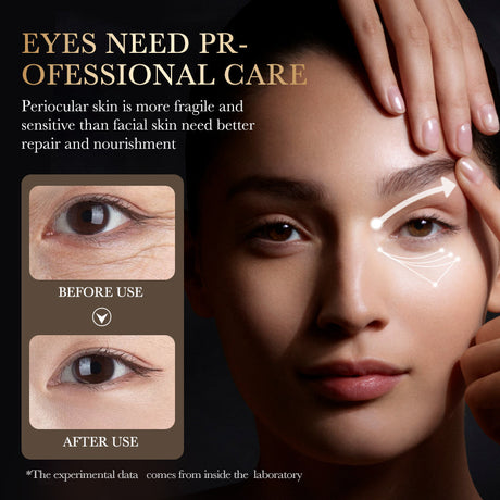 Gold Hyaluronic Acid Anti-wrinkle Multi-Effect Eye Cream